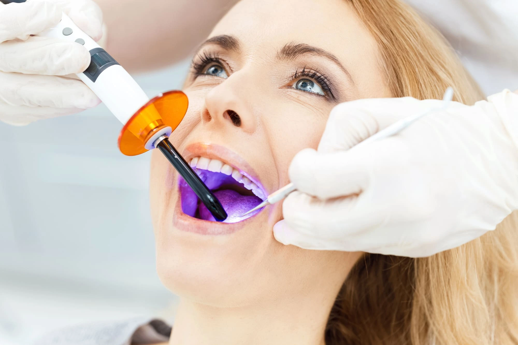 Blanqueamiento Dental