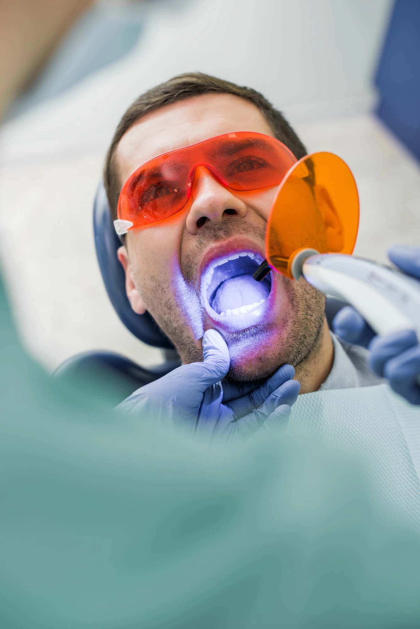 El mejor blanqueamiento dental de Torrejón